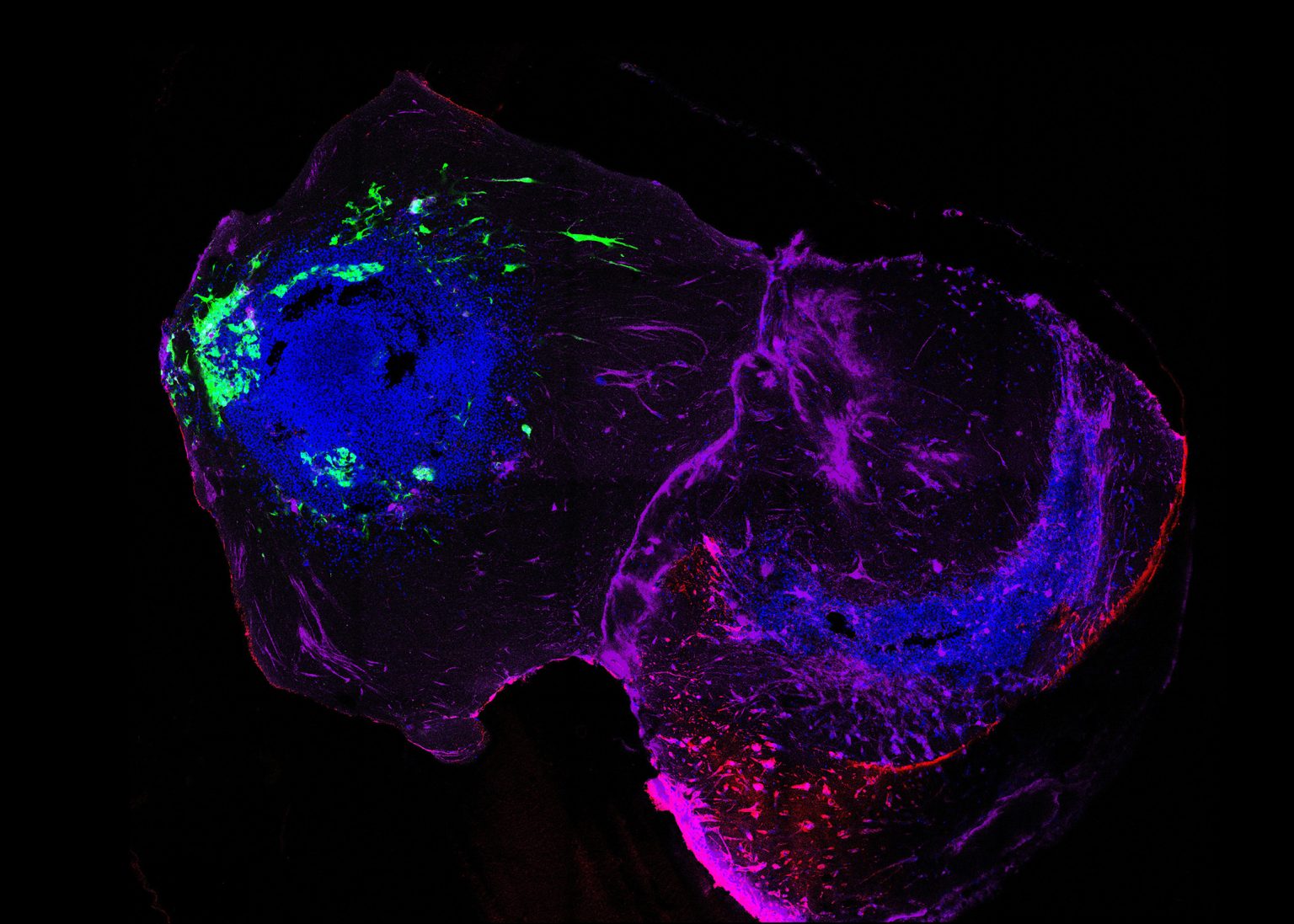 LCSB scientists reveal Parkinson’s disease spread using brain ...